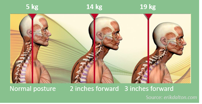 Head weight of Upper Crossed Syndrome
