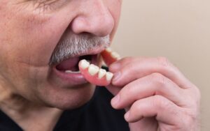 Elderly with tooth loss wearing dentures