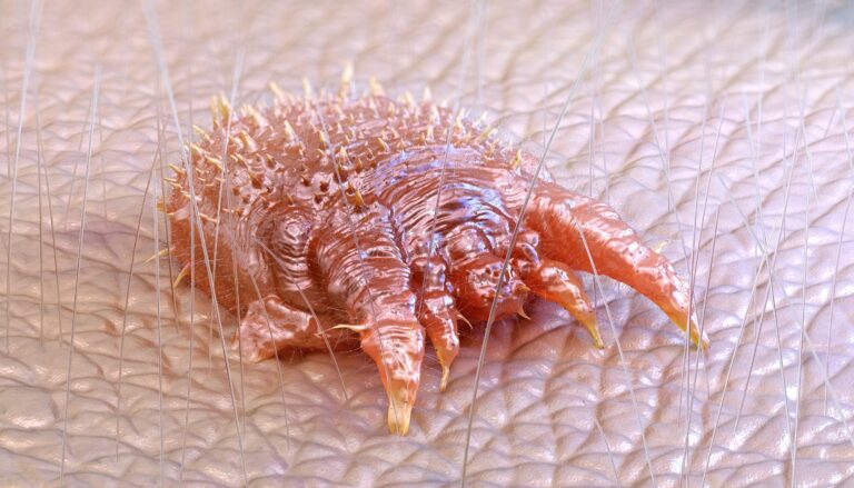Sarcoptes scabiei var. hominis on skin