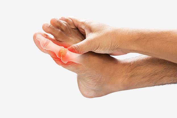 Gout in the elderly